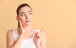 Serum Acne